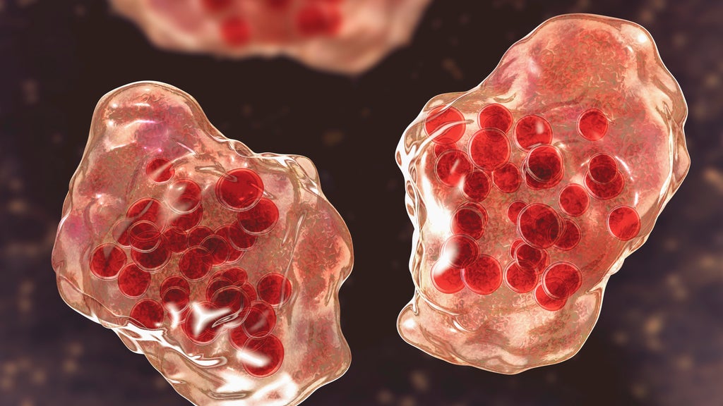 Central Minnesota county reports "several cases of suspected measles" — WCCO / CBS Minnesota, Lakeville Health news