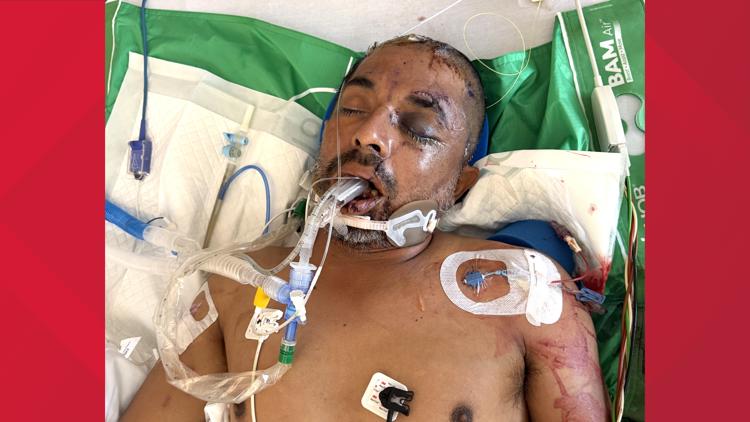 University Hospital asks for help identifying unconscious patient hit by truck Saturday evening — KENS 5 (San Antonio), Lakeville Health news